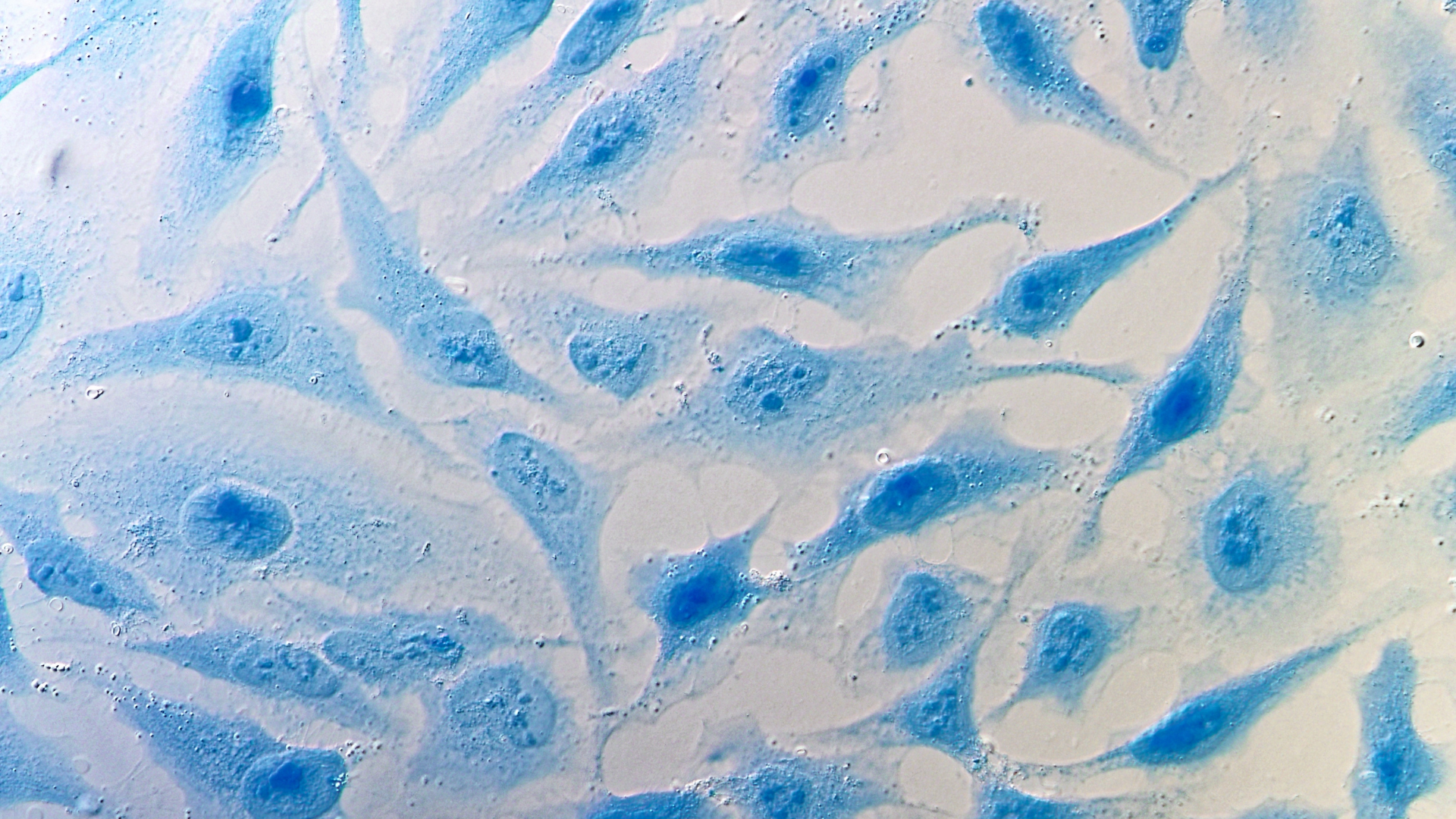 HeLa cells